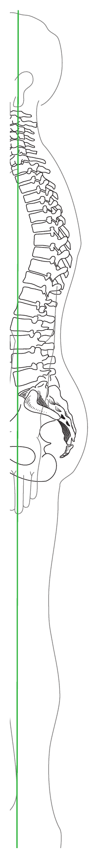 Schéma de profil de la colonne vertébrale avec fil à plomb vertical illustrant l'alignement oreille - épaule - hanche