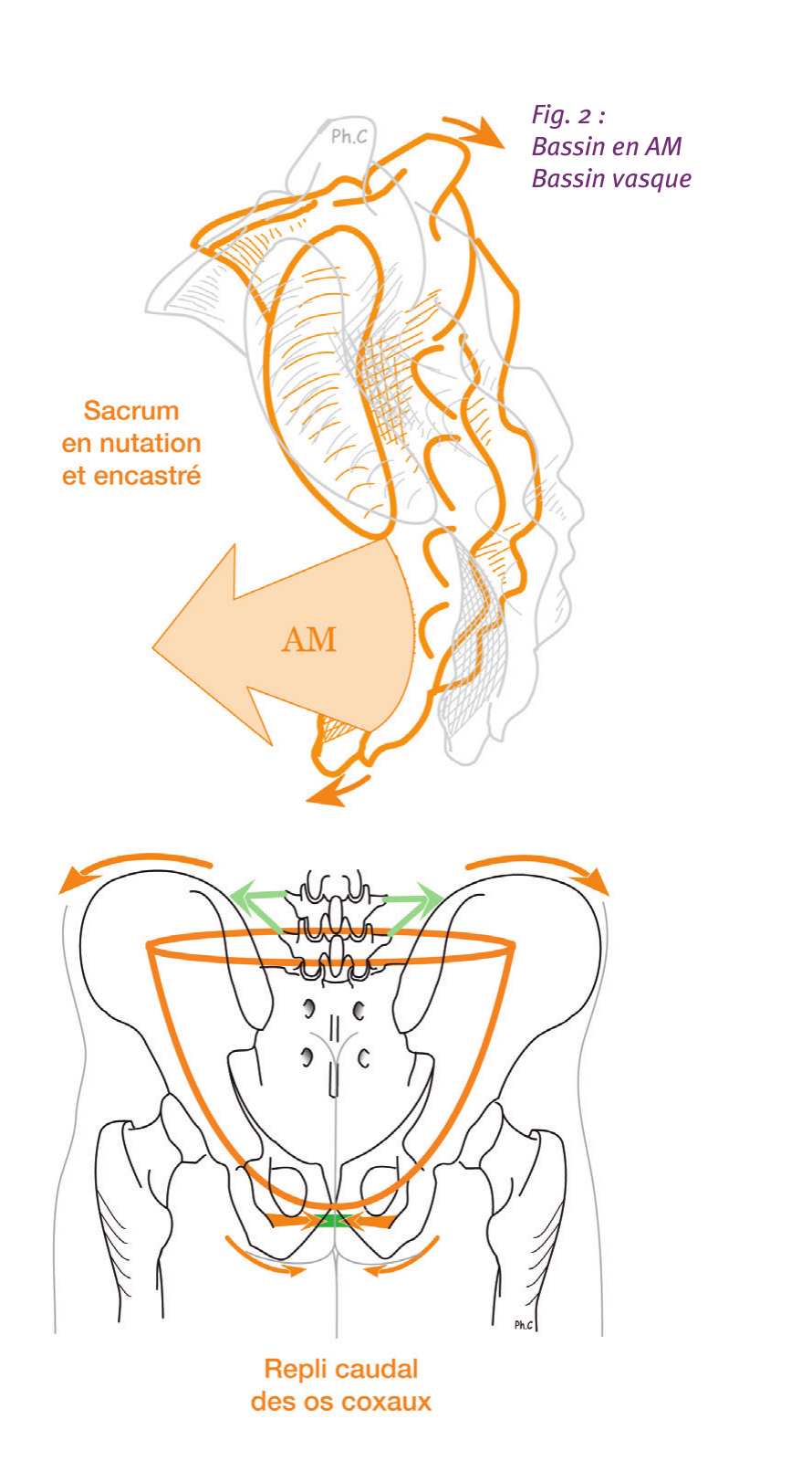 Schéma du bassin en AM (bassin vasque) : sacrum en nutation et encastré, repli caudal des os coxaux, et radiographie d'un bassin en AM